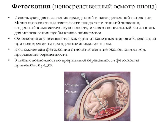 Фетоскопия (непосредственный осмотр плода) Используют для выявления врожденной и наследственной