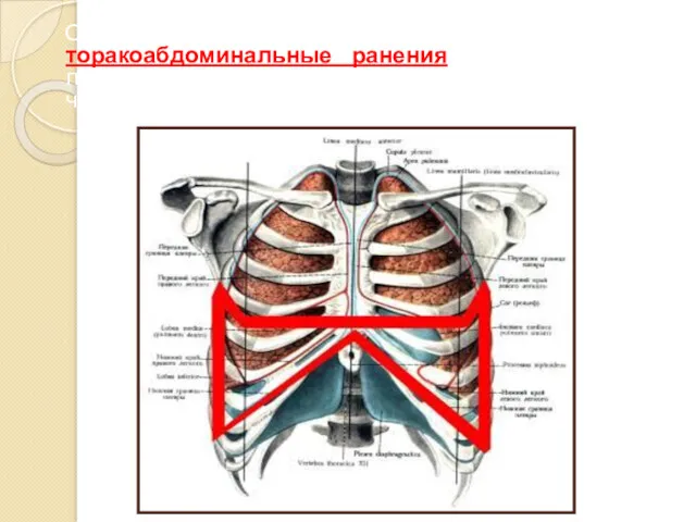 Отдельной группой выделяются торакоабдоминальные ранения, при которых повреждается диафрагма и