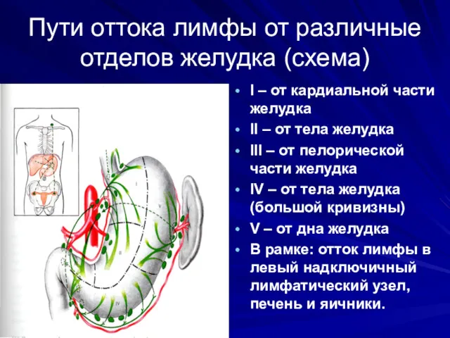 Пути оттока лимфы от различные отделов желудка (схема) I – от кардиальной части