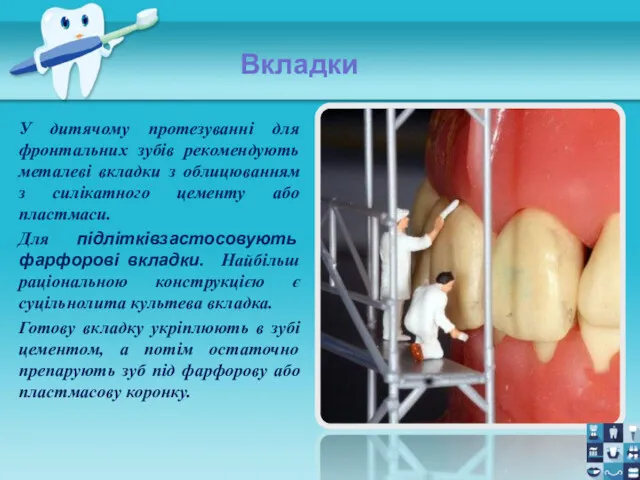 Вкладки У дитячому протезуванні для фронтальних зубів рекомендують металеві вкладки з облицюванням з