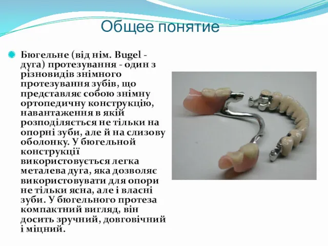 Общее понятие Бюгельне (від нім. Bugel - дуга) протезування -