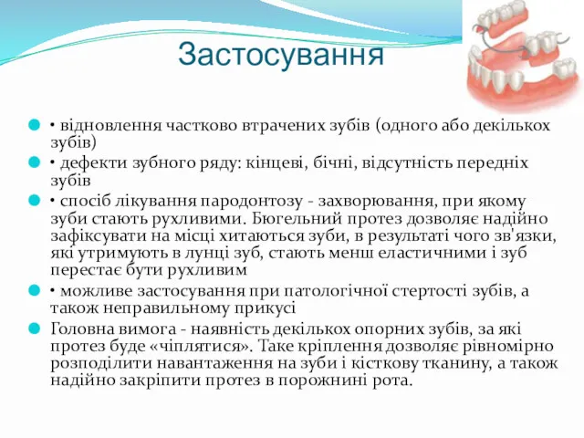 Застосування • відновлення частково втрачених зубів (одного або декількох зубів)