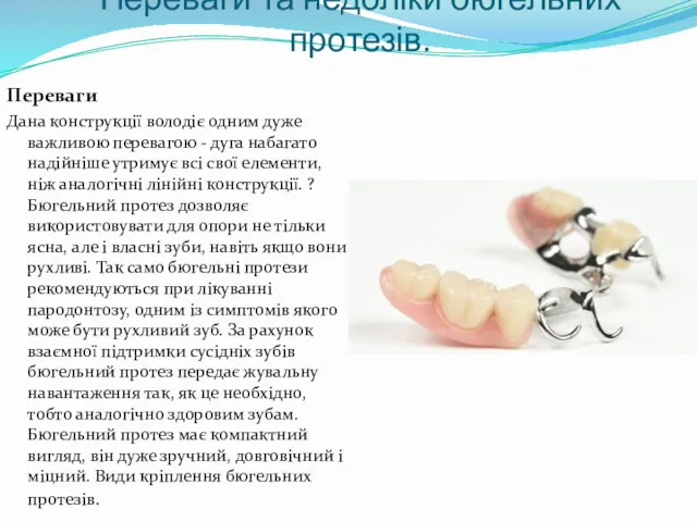 Переваги та недоліки бюгельних протезів. Переваги Дана конструкції володіє одним