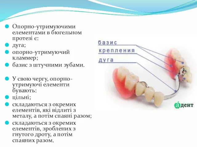 Опорно-утримуючими елементами в бюгельном протезі є: дуга; опорно-утримуючий кламмер; базис