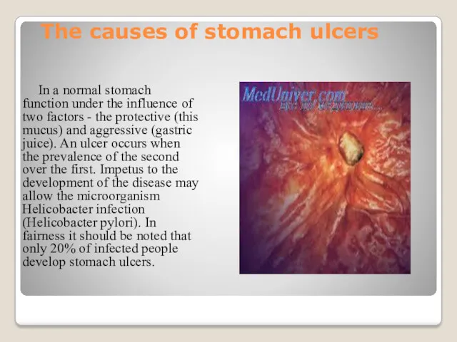 The causes of stomach ulcers In a normal stomach function