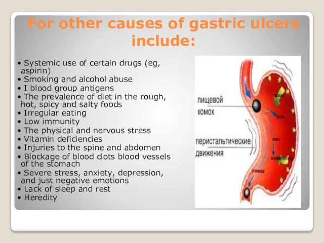 For other causes of gastric ulcers include: • Systemic use