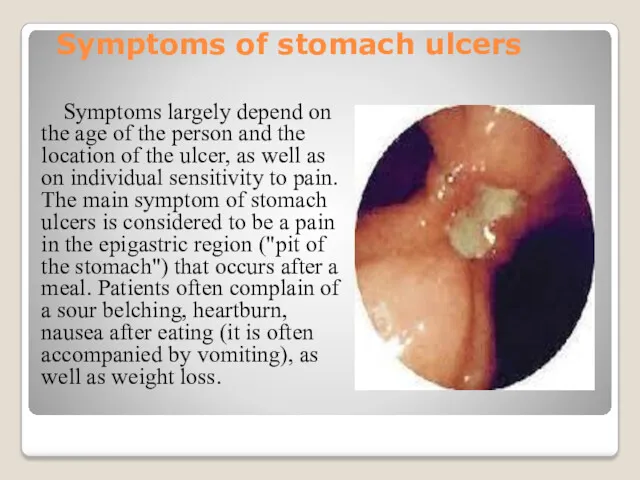 Symptoms of stomach ulcers Symptoms largely depend on the age