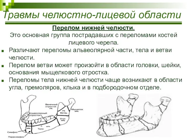 Травмы челюстно-лицевой области Перелом нижней челюсти. Это основная группа пострадавших