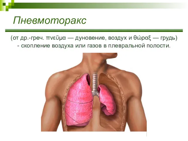 Пневмоторакс (от др.-греч. πνεῦμα — дуновение, воздух и θώραξ —