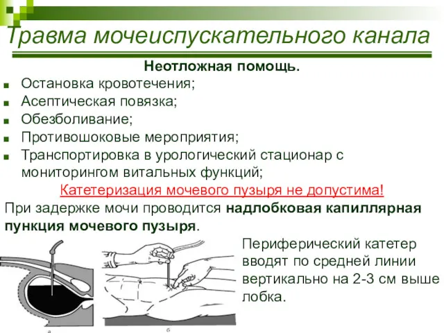 Травма мочеиспускательного канала Неотложная помощь. Остановка кровотечения; Асептическая повязка; Обезболивание;