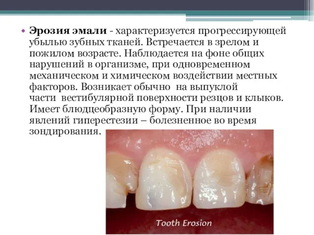 Эрозия эмали - характеризуется прогрессирующей убылью зубных тканей. Встречается в