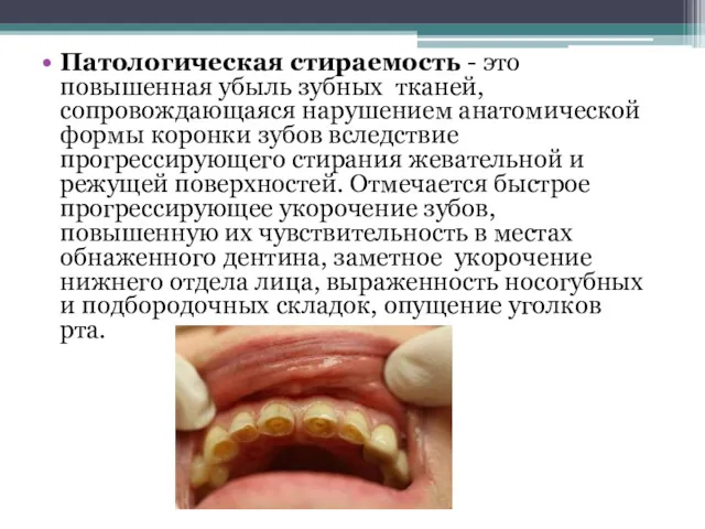 Патологическая стираемость - это повышенная убыль зубных тканей, сопровождающаяся нарушением