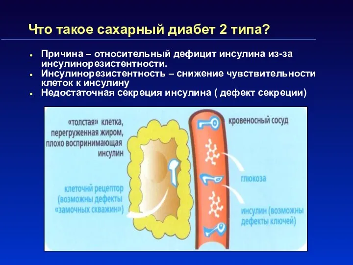 Что такое сахарный диабет 2 типа? Причина – относительный дефицит