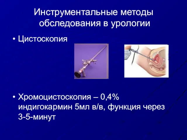 Инструментальные методы обследования в урологии Цистоскопия Хромоцистоскопия – 0,4% индигокармин 5мл в/в, функция через 3-5-минут