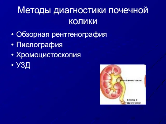 Методы диагностики почечной колики Обзорная рентгенография Пиелография Хромоцистоскопия УЗД