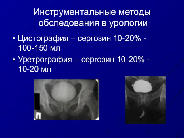 Инструментальные методы обследования в урологии Цистография – сергозин 10-20% -