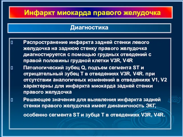 Инфаркт миокарда правого желудочка Распространение инфаркта задней стенки левого желудочка