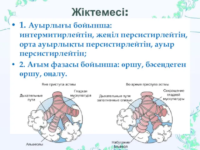 Жіктемесі: 1. Ауырлығы бойынша: интермитирлейтін, жеңіл персистирлейтін, орта ауырлықты персистирлейтін,