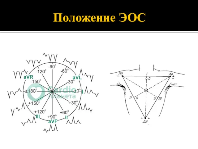 Положение ЭОС