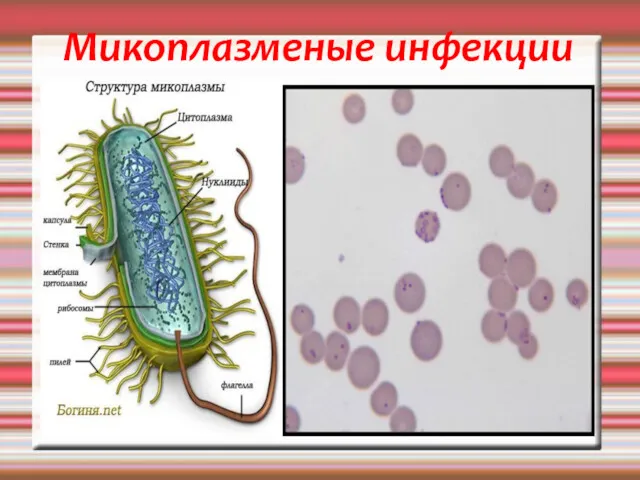 Микоплазменые инфекции