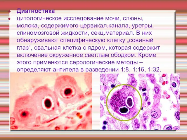 Диагностика цитологическое исследование мочи, слюны, молока, содержимого цервикал.канала, уретры, спиномозговой