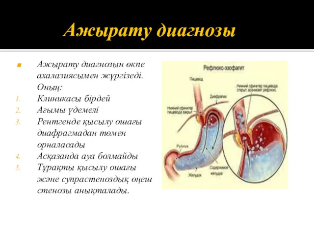 Ажырату диагнозы Ажырату диагнозын өкпе ахалазиясымен жүргізеді. Оның: Клиникасы бірдей