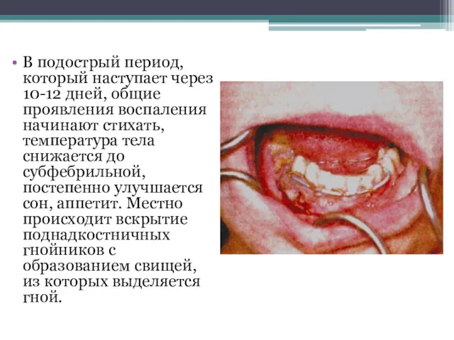 В подострый период, который наступает через 10-12 дней, общие проявления