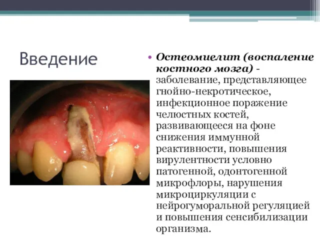 Введение Остеомиелит (воспаление костного мозга) - заболевание, представляющее гнойно-некротическое, инфекционное