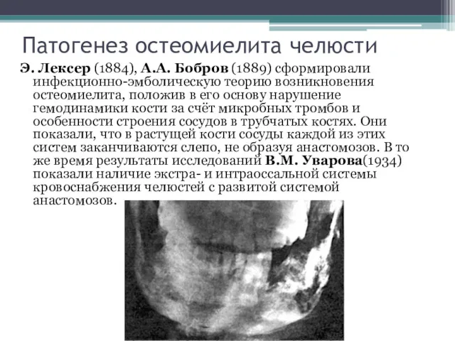 Патогенез остеомиелита челюсти Э. Лексер (1884), А.А. Бобров (1889) сформировали