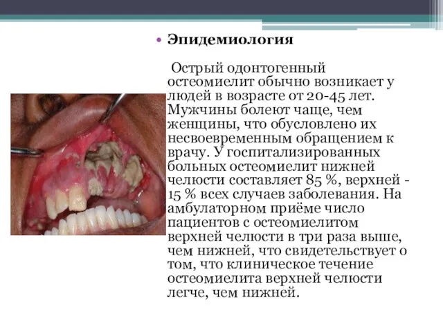 Эпидемиология Острый одонтогенный остеомиелит обычно возникает у людей в возрасте