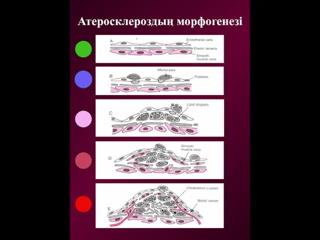 Атеросклероздың морфогенезі