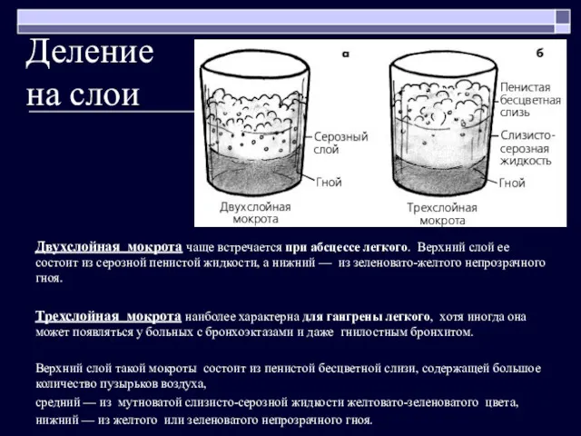 Деление на слои Двухслойная мокрота чаще встречается при абсцессе легкого.