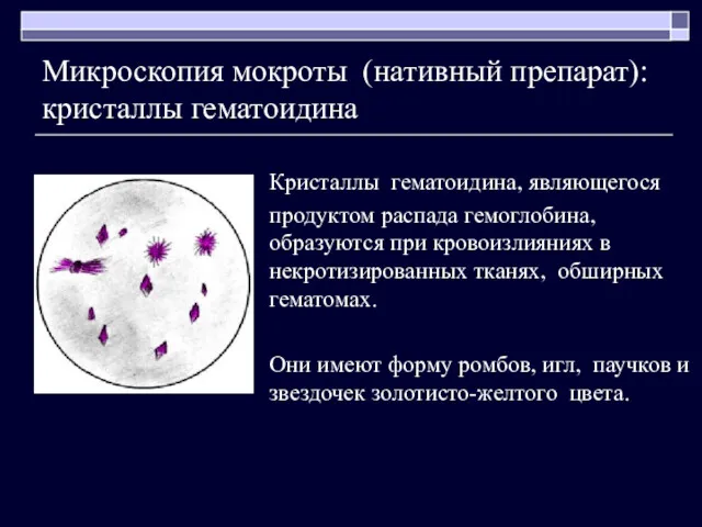 Микроскопия мокроты (нативный препарат): кристаллы гематоидина Кристаллы гематоидина, являющегося продуктом распада гемоглобина, образуются