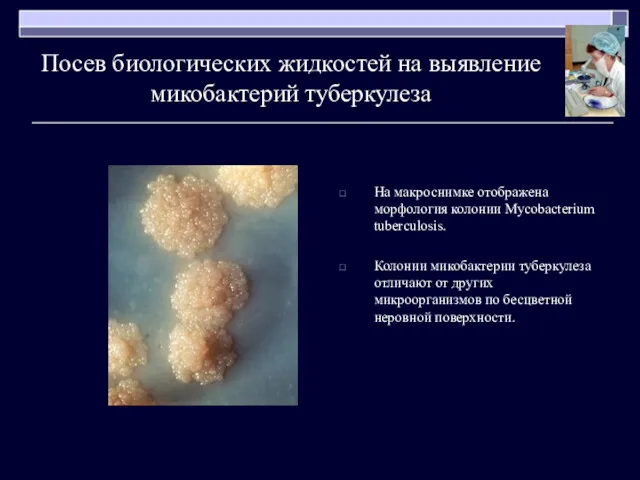 Посев биологических жидкостей на выявление микобактерий туберкулеза На макроснимке отображена морфология колонии Mycobacterium