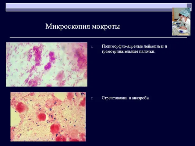 Полиморфно-ядреные лейкоциты и грамотрицательные палочки. Стрептококки и анаэробы Микроскопия мокроты