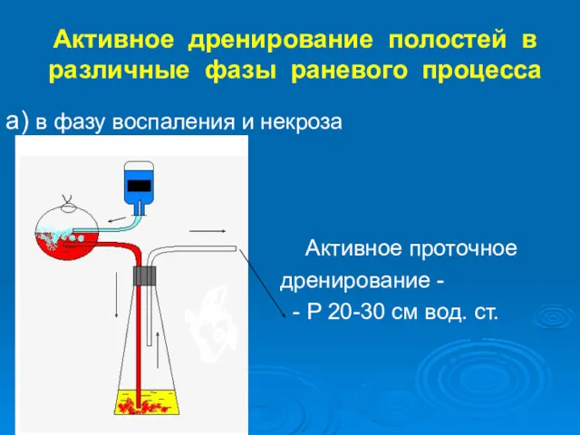 Активное дренирование полостей в различные фазы раневого процесса а) в