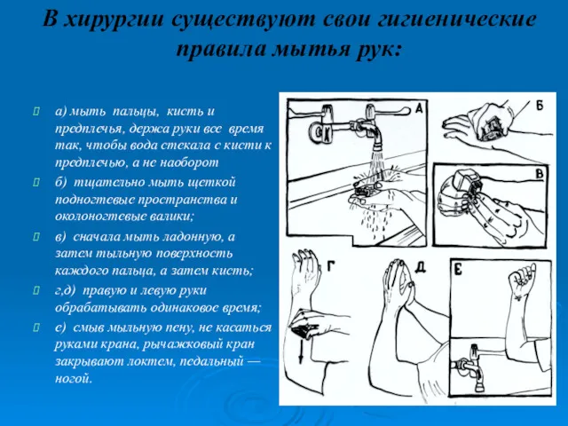 В хирургии существуют свои гигиенические правила мытья рук: а) мыть