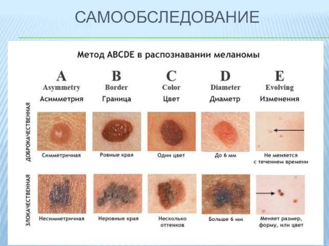 САМООБСЛЕДОВАНИЕ