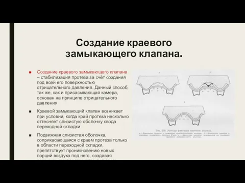 Создание краевого замыкающего клапана. Создание краевого замыкающего клапана – стабилизация