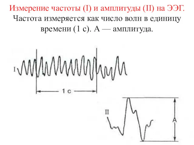 Измерение частоты (I) и амплитуды (II) на ЭЭГ. Частота измеряется