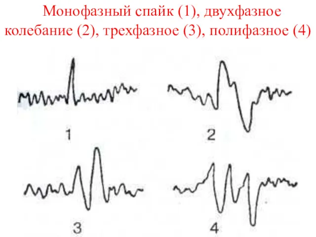 Монофазный спайк (1), двухфазное колебание (2), трехфазное (3), полифазное (4)