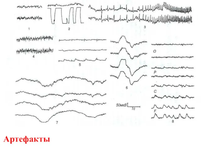 Артефакты