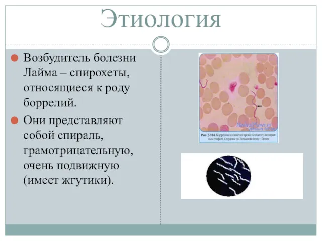 Этиология Возбудитель болезни Лайма – спирохеты, относящиеся к роду боррелий.