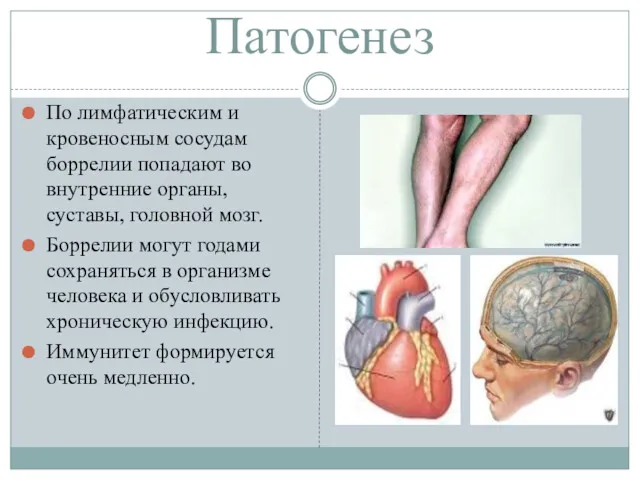 Патогенез По лимфатическим и кровеносным сосудам боррелии попадают во внутренние