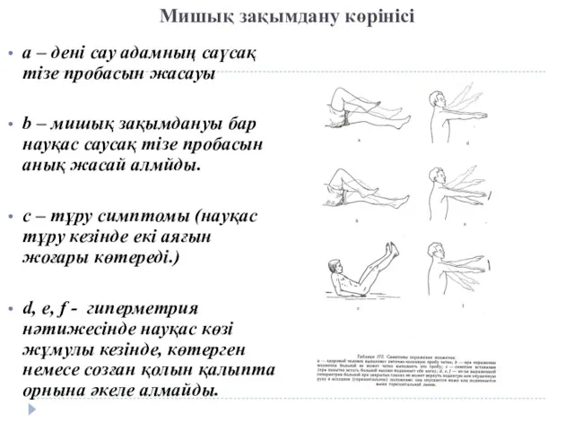 Мишық зақымдану көрінісі а – дені сау адамның саүсақ тізе