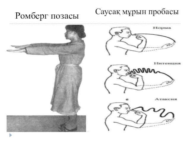 Ромберг позасы Саусақ мұрын пробасы