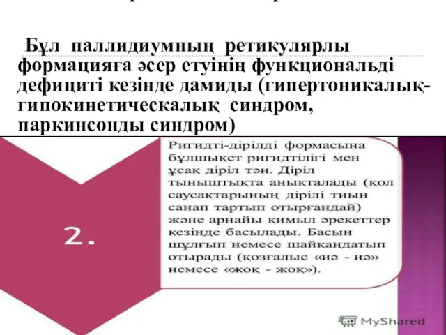 Акинетика-ригидтілік синдромы Бұл паллидиумның ретикулярлы формацияға әсер етуінің функциональді дефициті кезінде дамиды (гипертоникалық-гипокинетическалық синдром, паркинсонды синдром)