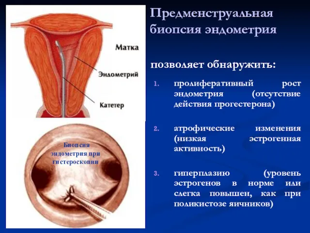 Предменструальная биопсия эндометрия позволяет обнаружить: пролиферативный рост эндометрия (отсутствие действия