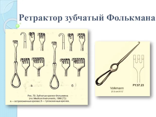 Ретрактор зубчатый Фолькмана