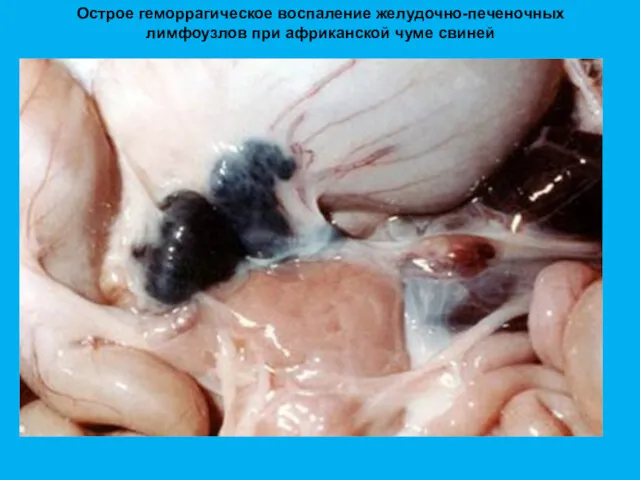 Острое геморрагическое воспаление желудочно-печеночных лимфоузлов при африканской чуме свиней